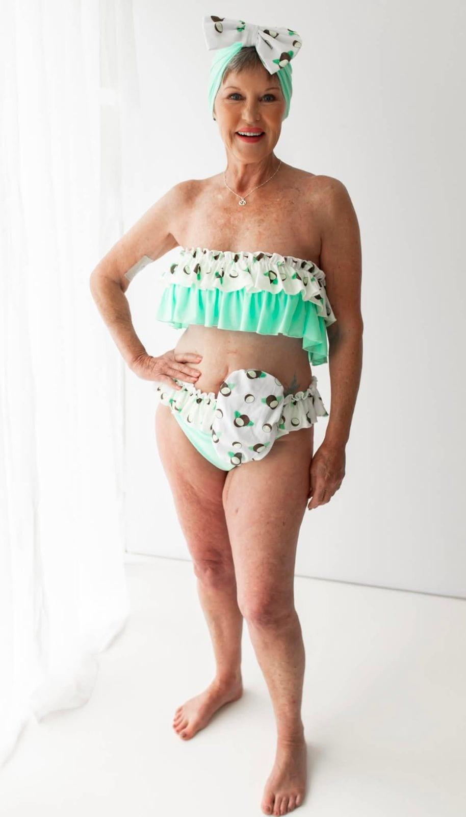 Tony, modelling Fruity & Frilly's coconut-print swimwear — the inspiration for the Tony Range